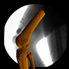 Jump Cut: X-ray video & XROMM animation