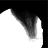 X-Ray Movie: Ventro-dorsal view